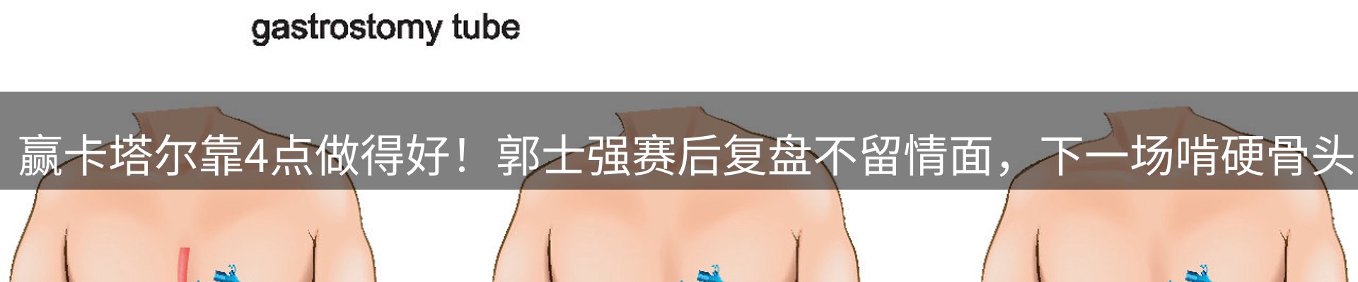 热点展望